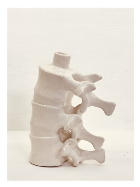 Vertebra